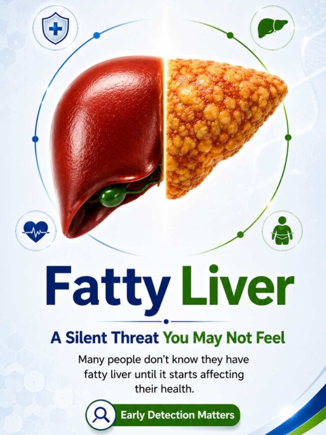 Fatty Liver – A Silent Condition That Often Shows No Symptoms